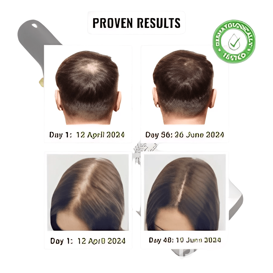 Pilgrim Hair Serum Review: The Best Hair Growth Serum for Stronger, Healthier Hair