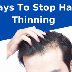 How to Reduce Hair Thinning Naturally: 10 Proven Tips & Treatments