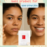 Best Pimple Patch for Clear Skin – Reviews, Benefits